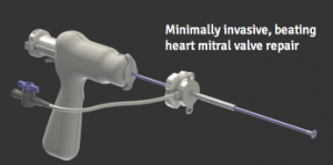 Harpoon Medical’s device could be used to treat degenerative heart disease.